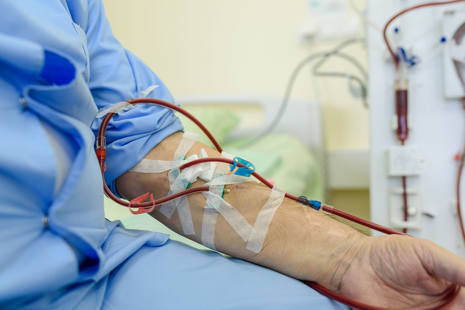 Home Nursing Services For Fistula Patients